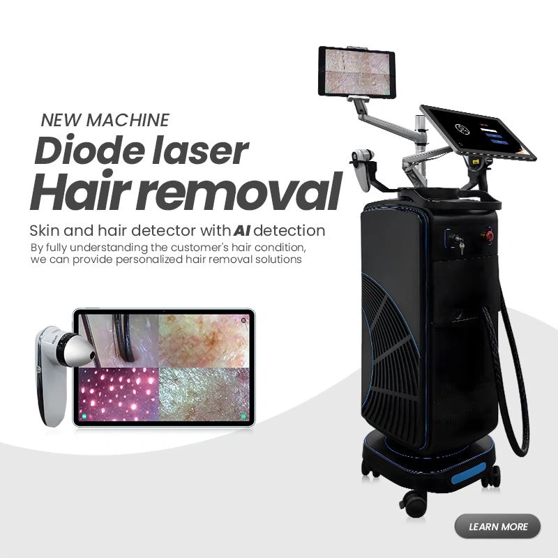 Gode ​​anmeldelser Diode Laser Hair Removal Machine i Canada