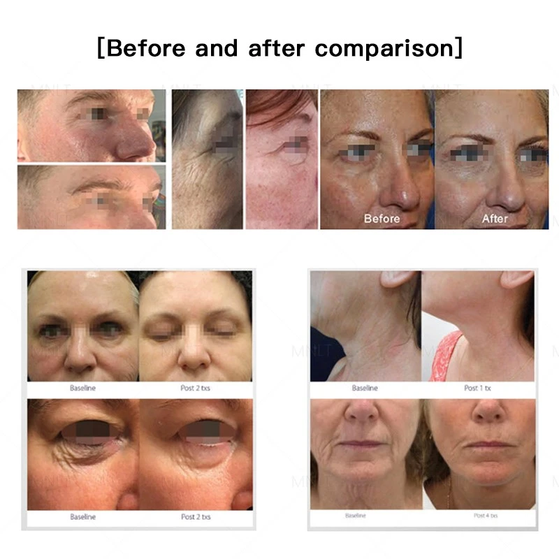 product-800-800 product-800-800